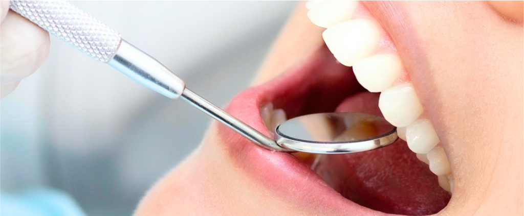Dental mirror in open mouth